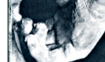 Landowski   Romains